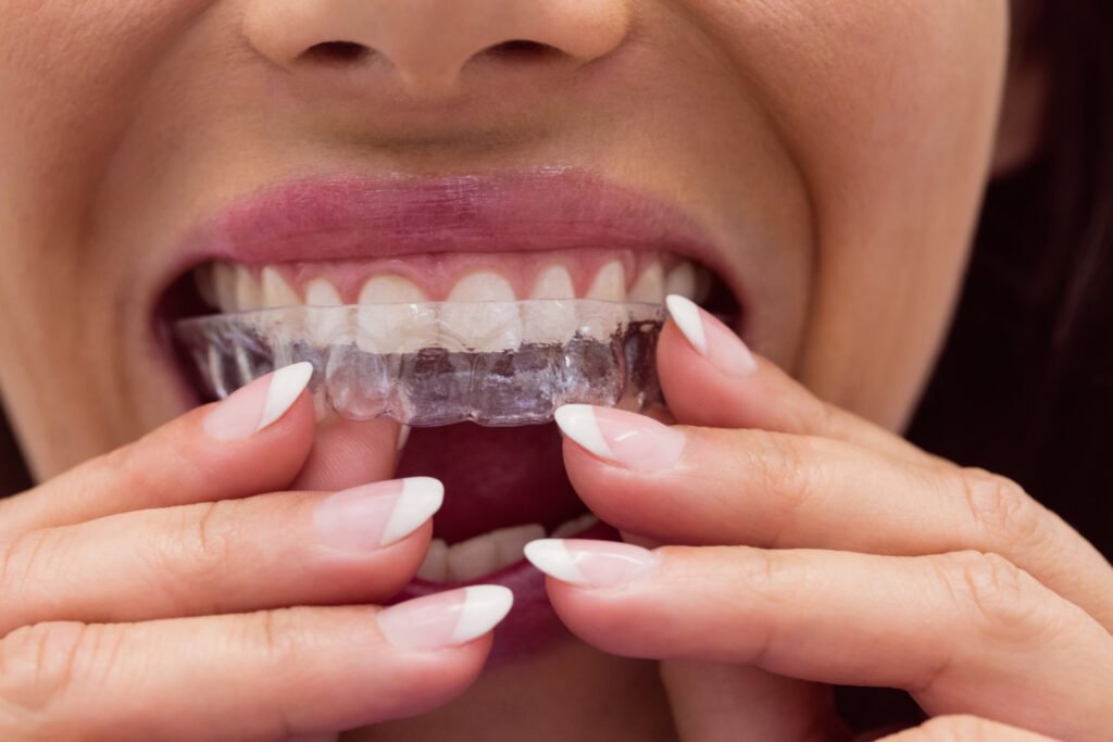 Paciente comparando brackets y alineadores invisibles en Cumbayá, ortodoncia profesional
